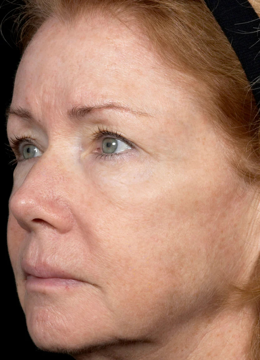 Velier | Dark Spot Peel Off Masker