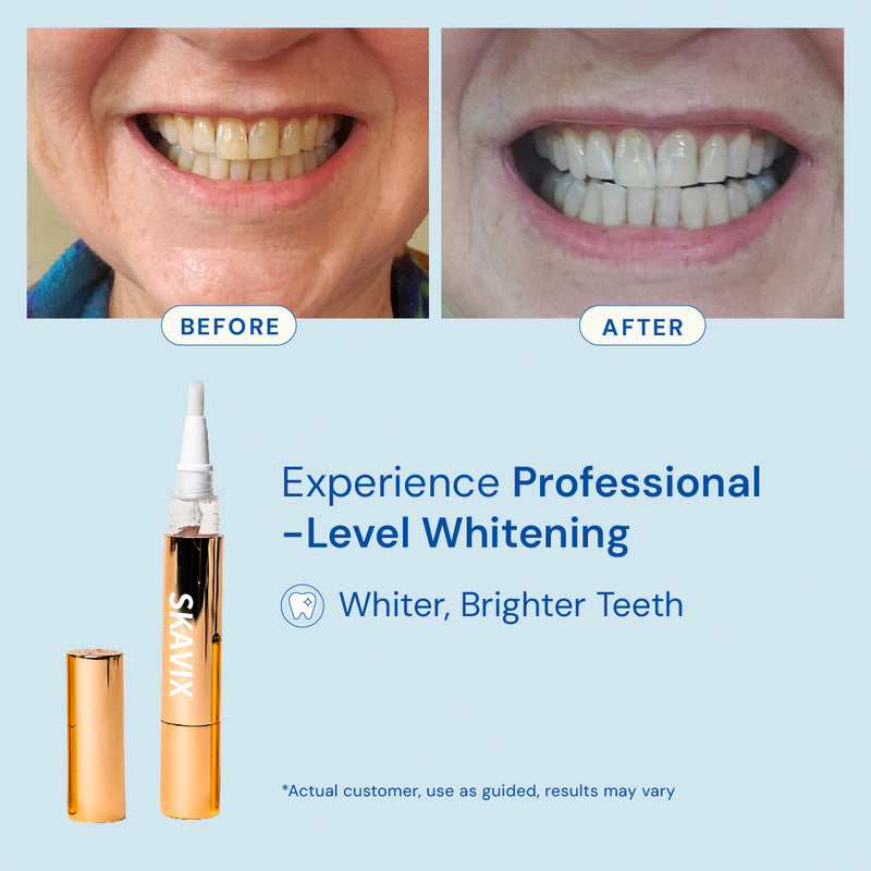 Tanden Bleek Serum Pen