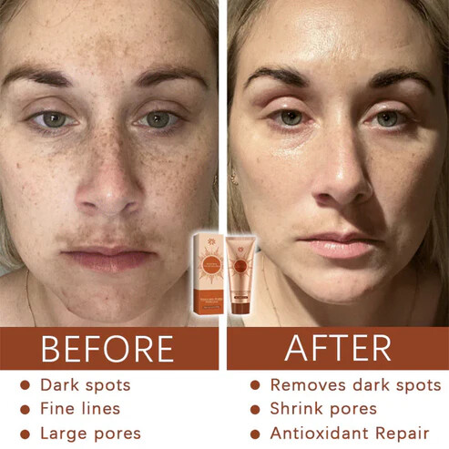 Velier | Dark Spot Peel Off Masker