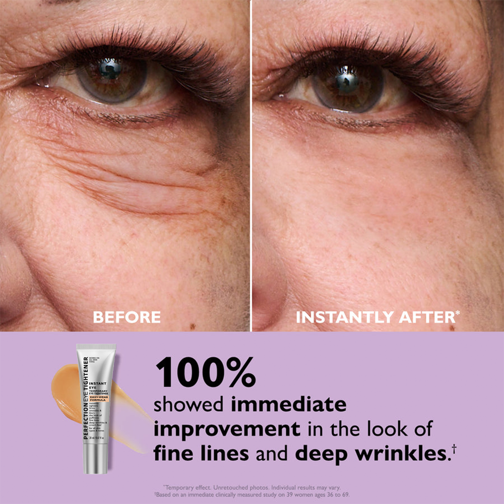 Perfection™ Instant Eye Tightener