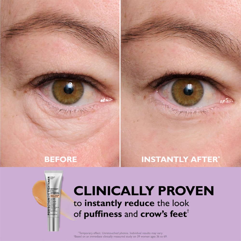 Perfection™ Instant Eye Tightener