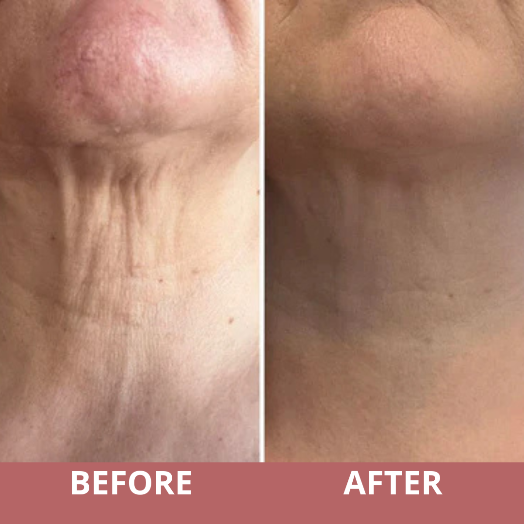 AH-8 Firming Lifting Neck Cream