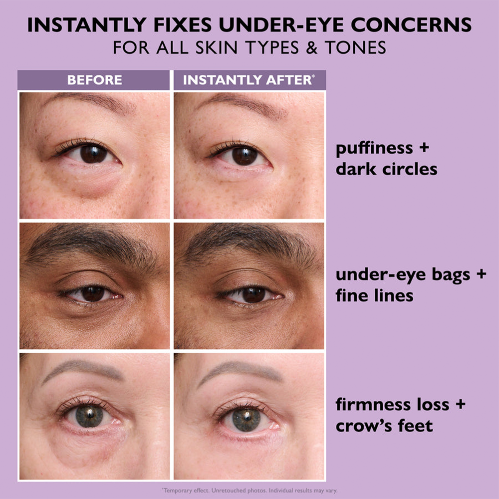 Perfection™ Instant Eye Tightener