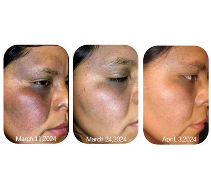 Velier | Dark Spot Peel Off Masker